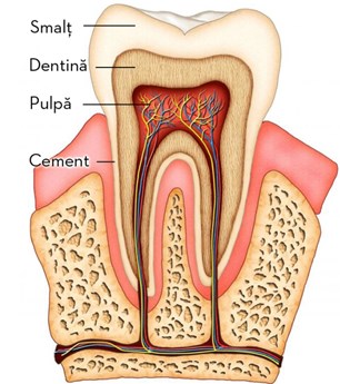 Terapie - caria dentara