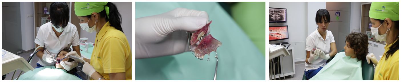 implantodent ortodontie adulti si copii copii_6