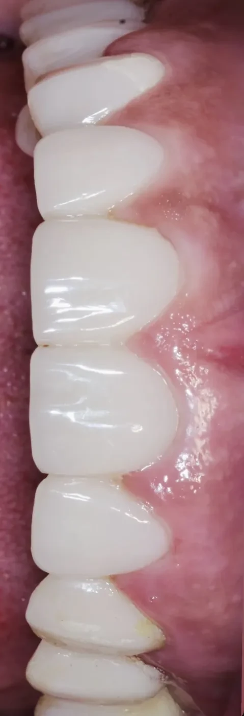Lucrarea FP1, detaliu vertical