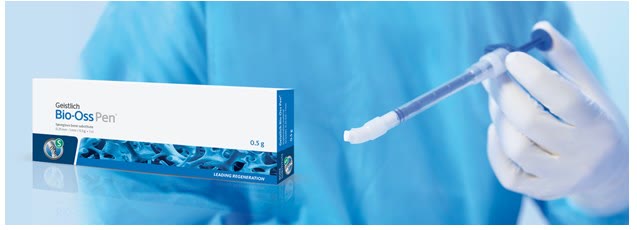 Substitut osos Geistlich Bio-Oss Pen, cu aplicatorul pregătit pentru introducerea granulelor în defectul osos