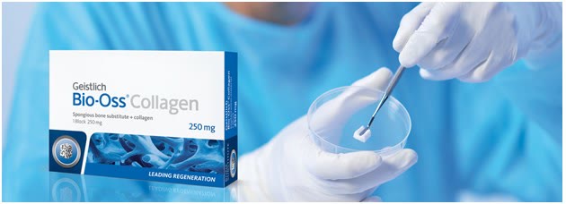 Substitut osos Geistlich Bio-Oss Collagen: blocul de os spongios cu colagen manipulat steril într-o casoletă