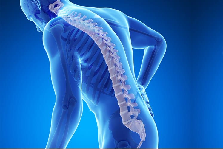 Ilustrație a coloanei vertebrale evidențiată la o persoană aplecată, sugerând fragilitatea osoasă din osteoporoză