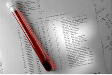 Eprubetă cu sânge așezată pe buletinul de analize de laborator cerute înainte de operația de implant