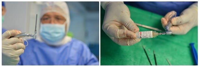 Instrumentar chirurgical specific pentru inserarea implanturilor zigomatice, pregătit în câmp steril