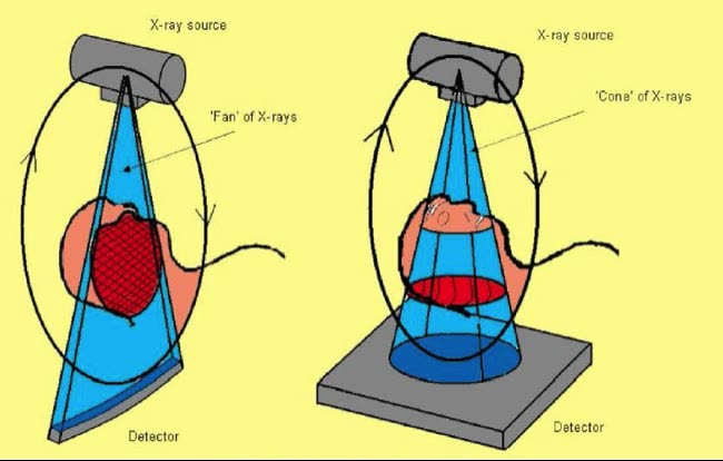 Schemă comparativă: tomograful clasic emite radiațiile în evantai, iar tomograful dentar CBCT le emite sub formă de con către placa de captură