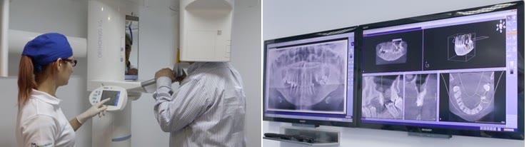 Tomograf dentar în timpul unei scanări și secțiunile tomografice 3D afișate pe monitoarele de planificare