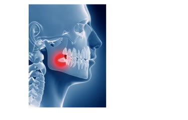 Ilustrație radiologică a craniului, cu zona molarului de minte inferior evidențiată în roșu