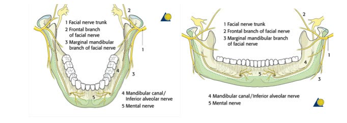Schemă anatomică a mandibulei cu traseul nervului facial, al canalului mandibular (nervul alveolar inferior) și al nervului mentonier