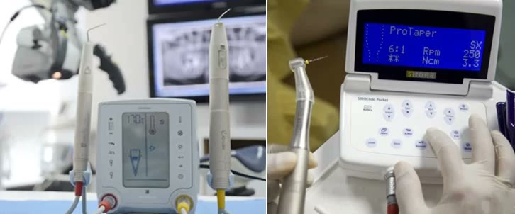 Aparatură de endodonție din dotarea clinicii: apexlocator cu piese de mână și motor endodontic rotativ cu turația și cuplul afișate pe ecran