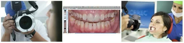 Fotografie diagnostică realizată cu aparat foto dentar și analiza digitală a zâmbetului pe calculator