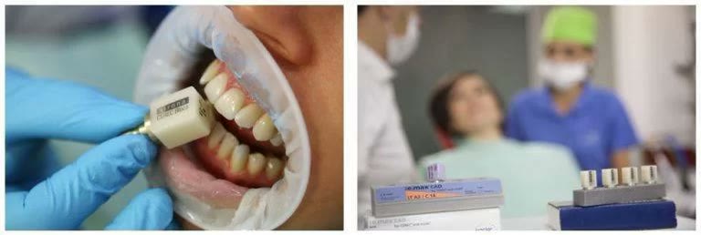Proba cubului de ceramică integrală lângă dinții pacientei și cutia cu blocuri de ceramică pe nuanțe