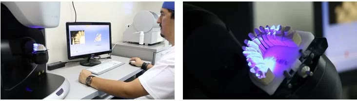 Medic protetician lucrând la unitatea CEREC și amprenta digitală a arcadei afișată pe modelul iluminat al scanerului