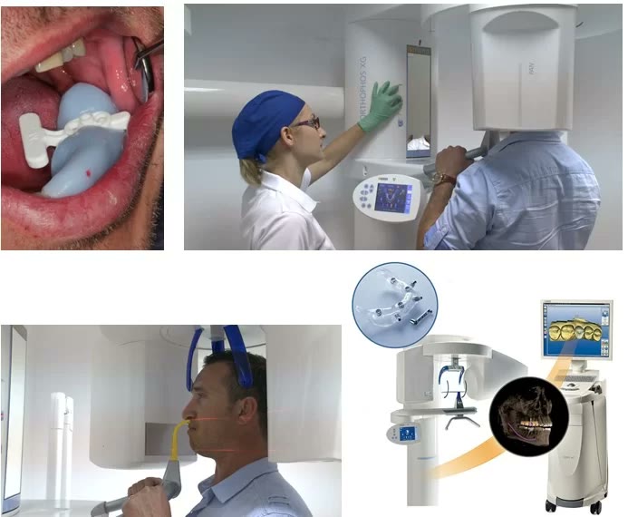 Șablonul radiologic aplicat în gura pacientului și scanarea la tomograful dentar 3D din dotarea clinicii