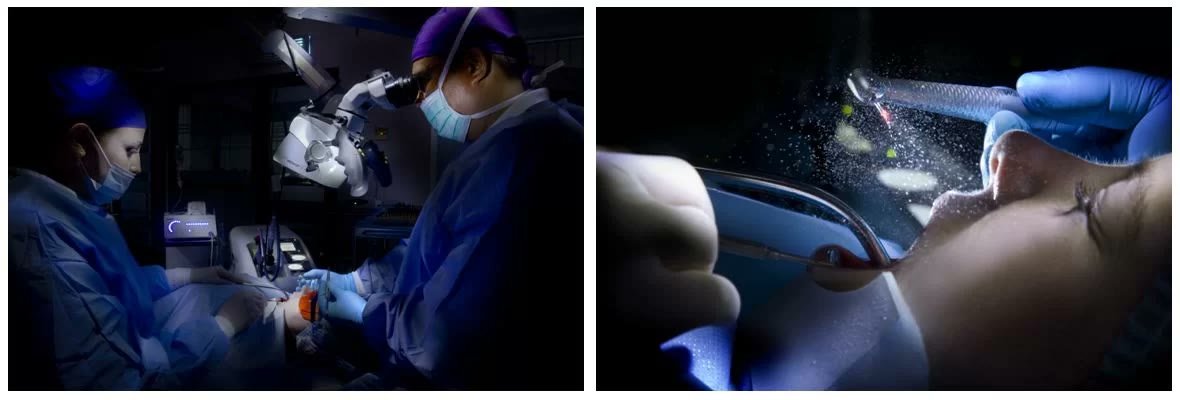 Tratament realizat sub microscop dentar de către echipa clinicii și fasciculul laser hidrokinetic, cu particulele de apă care lovesc dintele