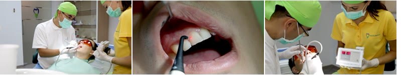 Detectarea cariilor în cabinet: examinarea pacientei, fasciculul detectorului laser pe suprafața dinților și aparatul de diagnostic folosit de echipă