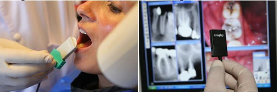 Senzor de radiologie digitală poziționat intraoral la o pacientă și radiografii dentare afișate pe monitorul din cabinet