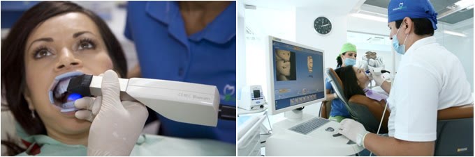 Amprentă optică luată cu scanerul CEREC la o pacientă și proiectarea digitală a incrustației din porțelan pe monitorul din cabinet