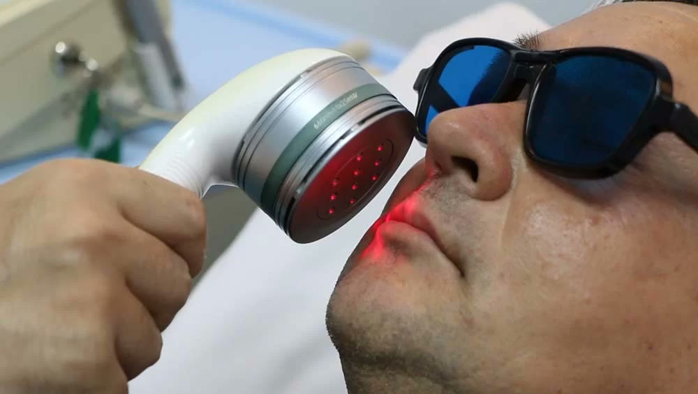 Ședință de terapie laser: aplicatorul cu diode roșii este ținut deasupra buzei pacientului, care poartă ochelari de protecție albaștri
