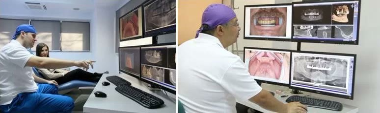 Consultație de specialitate de implantologie: medicul examinează pacientul și analizează imaginile pe monitor