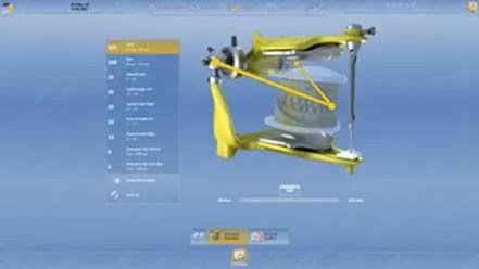 Amprentarea arcadelor maxilare, realizată digital sau clasic, pentru planificarea lucrării